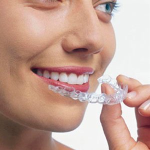 Invisalign for Teens: Straightening Smiles without Sacrificing Lifestyle in Las Vegas